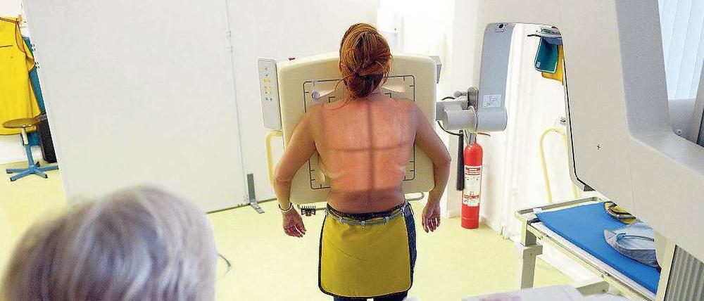 Durchleuchtet. Lungentuberkulose lässt sich mit einer Röntgenaufnahme aufspüren.