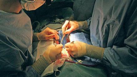 Herzenssache. Eine Bypass-Operation ist bei Mehrgefäßerkrankungen meist die bessere Wahl.