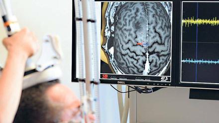 Millimetergenau. Eine Spule über dem Kopf des Patienten stimuliert das Gehirn. Anhand der Reaktionen lässt sich erkennen, welche Hirnareale für die Motorik sowie das Sprechen wichtig sind. 