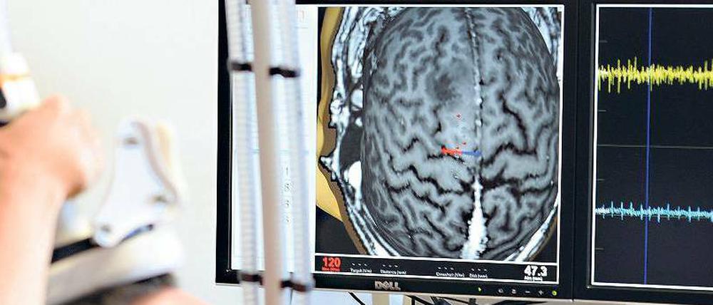 Millimetergenau. Eine Spule über dem Kopf des Patienten stimuliert das Gehirn. Anhand der Reaktionen lässt sich erkennen, welche Hirnareale für die Motorik sowie das Sprechen wichtig sind.