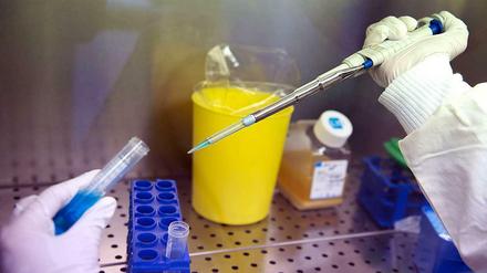 Experiment. Ob der Impfstoff wirklich gegen Ebola schützt, kann nur im Ausbruchsgebiet getestet werden. Zunächst ging es um die Verträglichkeit und die Frage, ob eine Immunantwort erzeugt wird.