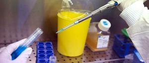 Experiment. Ob der Impfstoff wirklich gegen Ebola schützt, kann nur im Ausbruchsgebiet getestet werden. Zunächst ging es um die Verträglichkeit und die Frage, ob eine Immunantwort erzeugt wird.