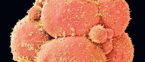 Anfang des Menschen. Die mikroskopische Aufnahme zeigt einen Embryo im Acht-Zell-Stadium.