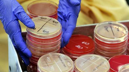 Bakterien, die gegen bestimmte Antibiotika resistent sind, werden durch diese nicht mehr gehemmt oder abgetötet.