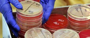 Bakterien, die gegen bestimmte Antibiotika resistent sind, werden durch diese nicht mehr gehemmt oder abgetötet.