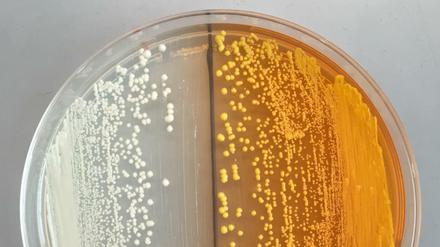 Neue, gentechnisch veränderte Hefezellen produzieren Vorläufer für Opiate (gelb gefärbt). Das kann die Herstellung von Arzneimitteln wie Morphin oder Antibiotika erleichtertn, eröffnet jedoch auch neue Möglichkeiten für die Herstellung illegaler Drogen.