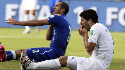 Chiellini (links) wurde bei der WM in Brasilien von Suárez gebissen.