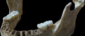 Ein Kiefer aus einer Höhle in Rumänien mit fünf Backenzähnen.