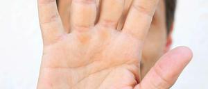 Zu wem gehört diese Hand?
