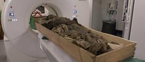 Auf der Aufnahme vom 15.12.2014 werden die Überreste des seit über 300 Jahren toten schwedischen Bischofs Peder Winstrup für eine Untersuchung in einen Computertomographen (CT) geschoben. Unter den Füßen des mumifizierten Geistlichen fanden Wissenschaftler die Leiche eines fünf bis sechs Monate alten Fötus, der vermutlich heimlich mit ihm in einem Sarg bestattet wurde.