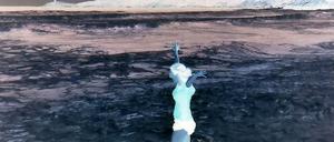 Erinnerung ans Sonnenbad: Heute muss Anna Lyndsey jedes Licht meiden.