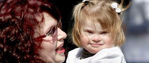 Bei Menschen mit Downsyndrom ist das Chromosom 21 dreifach in den Zellen vorhanden. Warum das so ist, war bislang unklar.