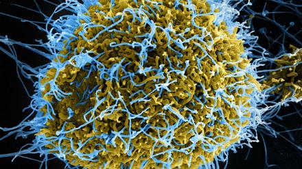 Ebola