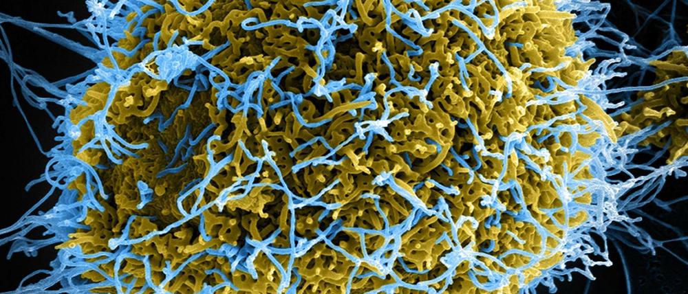 Ebola