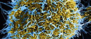 Ebola