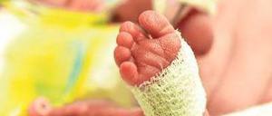 Erschwerter Start. Viele Frühgeburten werden durch Infektionen ausgelöst.