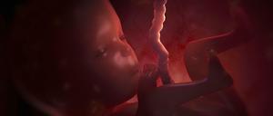 Ungeborener Patient. Föten mit offenem Rücken oder Herzklappenfehlern werden mitunter bereits im Mutterleib operiert. Sie sind dann etwa so alt wie dieses Kind in der 15. Schwangerschaftswoche. 