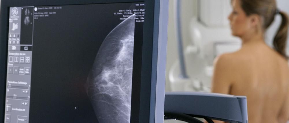 Wenn bei der Mammografie ein "duktales Karzinom" in der Brust entdeckt wird, verbessert eine radikale Amputation die Überlebenswahrscheinlichkeit nicht, so eine Studie an über 100.000 Frauen.