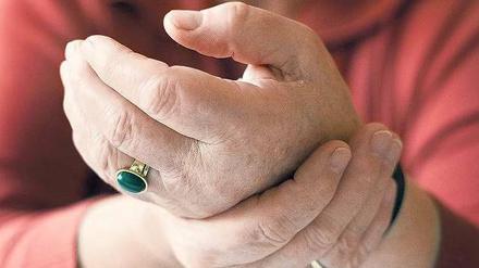 Geschwollen. Arthrose kann an unterschiedlichen Körperteile auftreten. Knie und Hüften sind am häufigsten betroffen, dann die Hände. Oft wird das Leiden mit der entzündlichen rheumatischen Arthritis verwechselt. Foto: Imago
