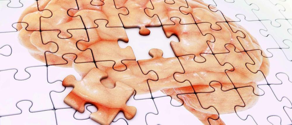 Unvollständiges Bild. Ein Puzzle mit einem Foto des Gehirns, von dem ein Teil fehlt.