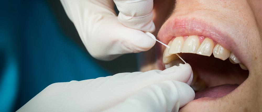 Professionelle Zahnreinigungen können helfen, das Gebiss gesund zu halten und entzündlichen Erkrankungen nicht nur des Zahnfleischs vorbeugen.