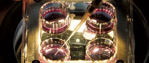 Kinderwunschbehandlung