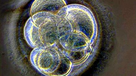 Wenn dem frühen Stadium eines Embryos, der aufgrund eines Gendefekts keine Niere bilden kann, genetisch intakte Stammzellen untergeschoben werden, dann können die Stammzellen dieses Organ bilden. So könnten in Tieren Organe aus menschlichen Zellen gezüchtet werden.