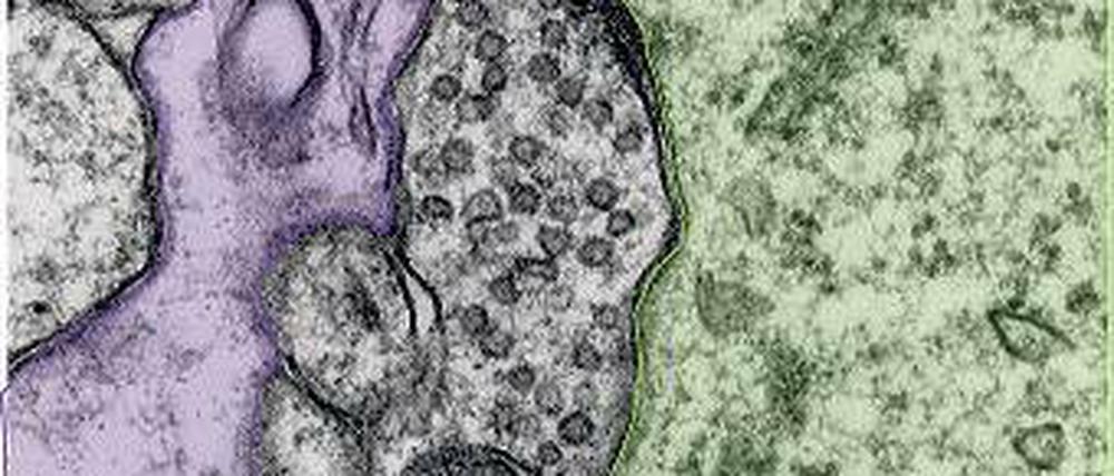 Elektronenmikroskopie. Hier sieht man zwischen einem Astrozyten (lila) und dem Zellkörper einer Nervenzelle (grün) eine von synaptischen Vesikeln gefüllte hemmende Synapse. Die Abwesenheit des Proteins AP180 führt dazu, dass die Signalweiterleitung dort gestört ist.