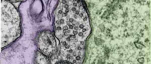 Elektronenmikroskopie. Hier sieht man zwischen einem Astrozyten (lila) und dem Zellkörper einer Nervenzelle (grün) eine von synaptischen Vesikeln gefüllte hemmende Synapse. Die Abwesenheit des Proteins AP180 führt dazu, dass die Signalweiterleitung dort gestört ist.