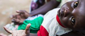 Neun Prozent aller Kinder weltweit leiden unter Auszehrung.