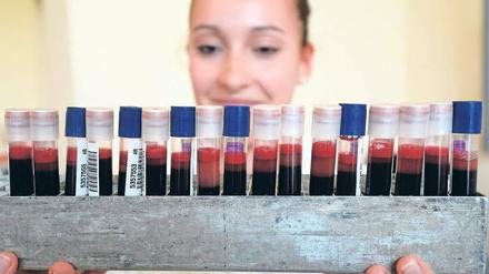 Die Gentherapie Glybera korrigiert einen Defekt, der das Blut verfettet.