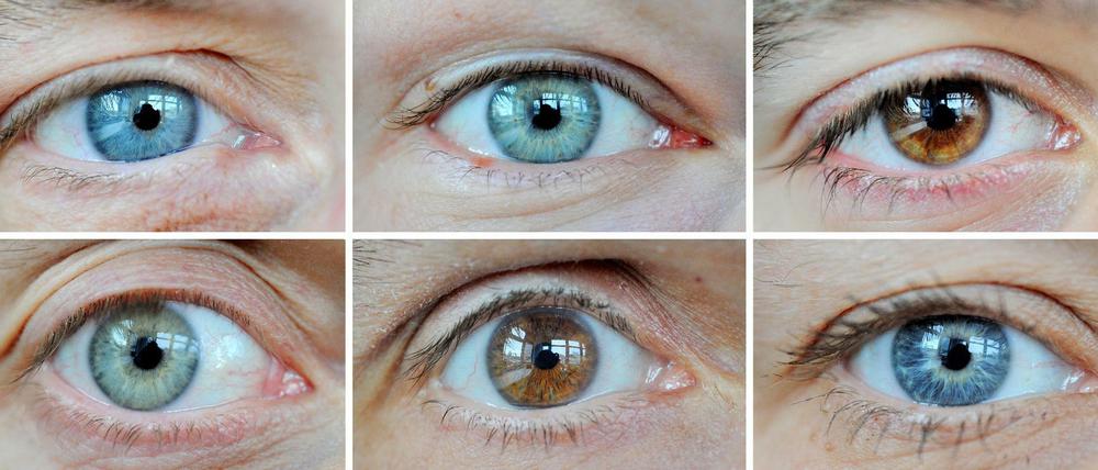 Augen