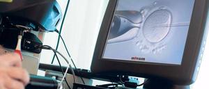 Spermien in Eizellen zu spritzen ist Routine in Befruchtungskliniken. Jetzt kann so auch mit unreifen Samenzellen Nachwuchs gezeugt werden.