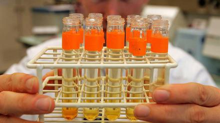 Hat der Leichtathletik-Weltverband das russische Staatsdoping in der Leichtathletik auch noch gedeckt?