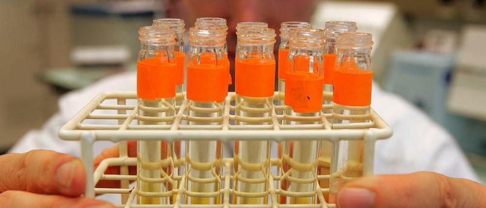 Hat der Leichtathletik-Weltverband das russische Staatsdoping in der Leichtathletik auch noch gedeckt?