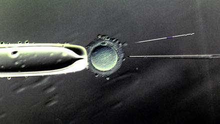 Künstlicher Zeugungsakt im biologischen Labor des Zentrums für Reproduktionsmedizin an der Universitätsfrauenklinik in Leipzig. 