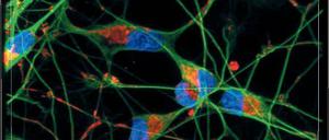 Neuronen. Udo Balling forscht an Parkinson. "Wir wollen das Gehirn als große Unbekannte angehen", sagt er.