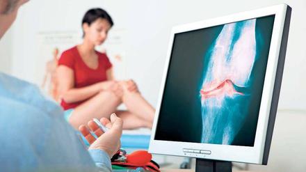 Die Deutsche Rheuma-Liga geht laut Gesundheitsministerium davon aus, dass 0,5 bis 0.8 Prozent der Bevölkerung an einer rheumatoiden Arthritis leiden. 