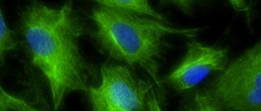 Im Thymusgewebe (hier grün gefärbte Thymuszellen, mit blau gefärbten Zellkernen) lernen die T-Zellen des Immunsystems, welche Strukturen körpereigen sind und nicht angegriffen werden sollen - bei Multipler Sklerose funktioniert das nicht mehr.