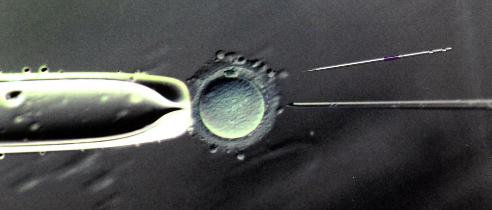 Auch Unverheiratete sollen künftig einen staatlichen Zuschuss bei künstlicher Befruchtung erhalten. 
