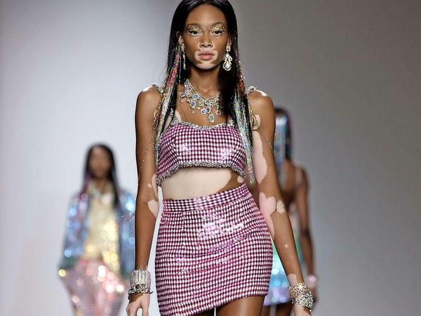 Modelt auch für Desigual: Chantelle Brown-Young.