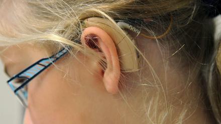 Die zehnjährige Lena Gunnarsson mit Cochlea Implantat im Cochlear Implant Centrum Berlin.