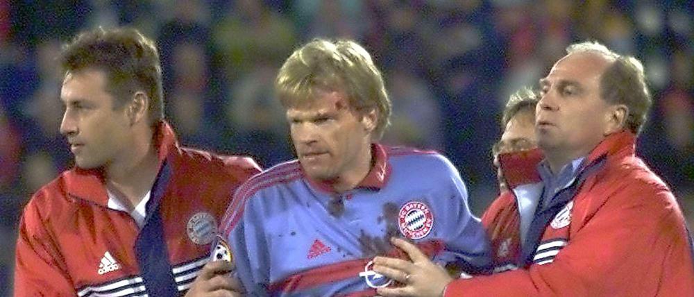 Blutige Angelegenheit. Bayern-Torwart Oliver Kahn wird im April 2000 im Gastspiel beim SC Freiburg von einem Golfball am Kopf getroffen. Einen Abbruch hatte das nicht zur Folge, die Bayern verzichteten sogar auf einen Protest - sie hatten ja eh 2:1 gewonnen. Täter war damals übrigens ein Schüler.