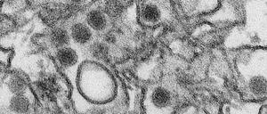 Zika-Viren, hier in einer elektronenmikroskopischen Aufnahme, sind etwa 40 Nanometer große, kugelförmige Viren der Flaviviridae-Familie. Sie stehen im Verdacht, der Hirnentwicklung von Kindern im Mutterleib infizierter Schwangerer zu schaden und bei Erwachsenen neurologische Komplikationen zu verursachen.
