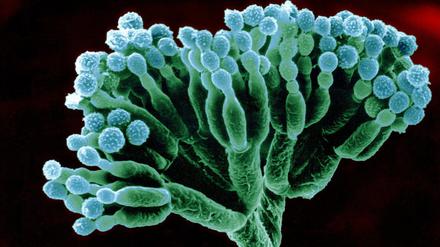 Nach diesem Schimmelpilz bekommt Penicillin seinen Namen