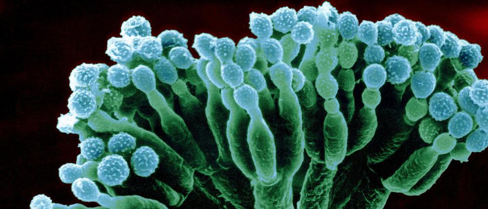 Nach diesem Schimmelpilz bekommt Penicillin seinen Namen