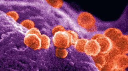 HIV