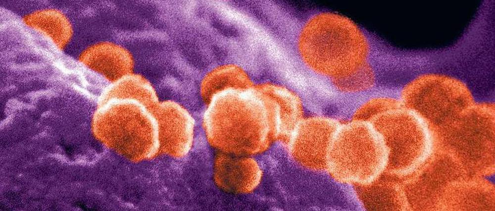 HIV