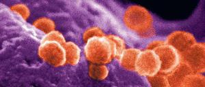 HIV