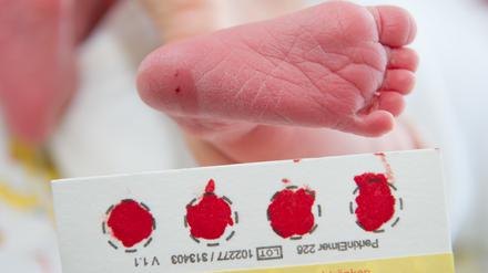 ARCHIV - An der Universitätsklinik in Greifswald (Mecklenburg-Vorpommern) wird am 31.03.2014 am Fuß eines Babys Blut für ein Neugeborenen-Screening abgenommen. Neugeborene in Mecklenburg-Vorpommern, im polnischen Westpommern und im nördlichen Brandenburg werden künftig im Rahmen der Früherkennung auf zusätzliche Erkrankungen untersucht. (zu dpa «Neugeborenen-Screening wird ausgeweitet: 45 000 Babys profitieren» vom 29.11.2017) Foto: Stefan Sauer/dpa-Zentralbild/dpa +++(c) dpa - Bildfunk+++ | Verwendung weltweit